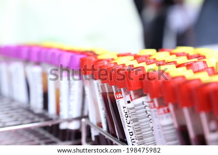 Blood tube for testing in laboratory Blood tube for testing in laboratory