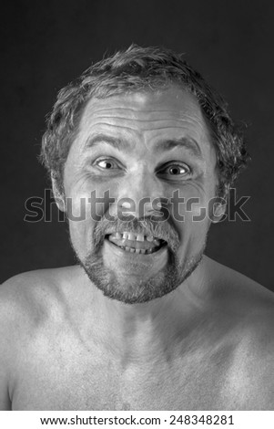 Drunk smily man sick with a hangover and a swollen face - stock-photo-drunk-smily-man-sick-with-a-hangover-and-a-swollen-face-248348281