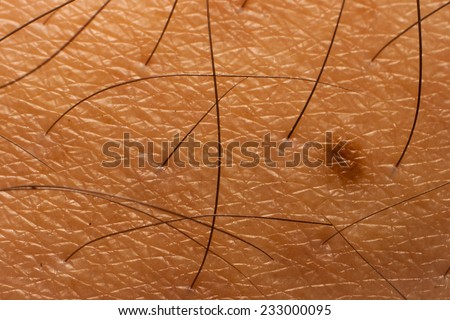 Closed up of skin with pigment and body hair