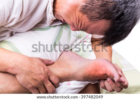 Man on bed with pillow embrace foot with painful swollen gout inflammation