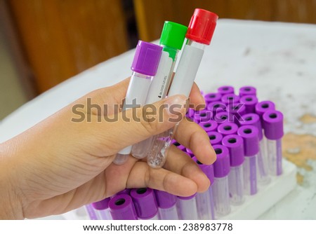 Medical Blood tube, test tube for laboratory