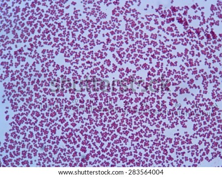 White blood cells of a human, photomicrograph panorama as seen under the microscope,  (Photo from microscope, magnification x 1000)