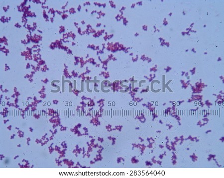 White blood cells of a human, photomicrograph panorama as seen under the microscope,  (Photo from microscope, magnification x 1000)