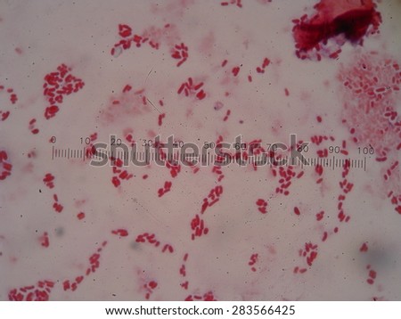 Human lymphocytes , panoramic Photomicrograph as seen under a microscope , ( pictures from microscope magnification x 1000).