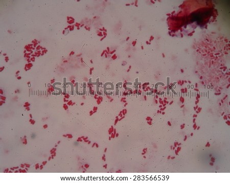Human lymphocytes , panoramic Photomicrograph as seen under a microscope , ( pictures from microscope magnification x 1000).