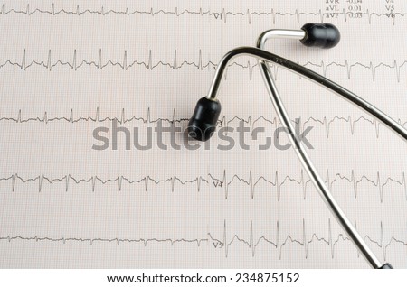 medical examination, electrocardiogram, heart medicine and therapy