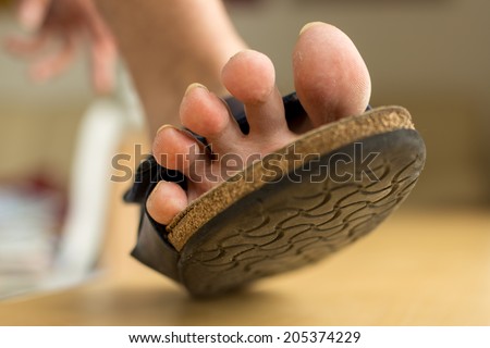 Dry feet with skin peeling off in a shoe walking