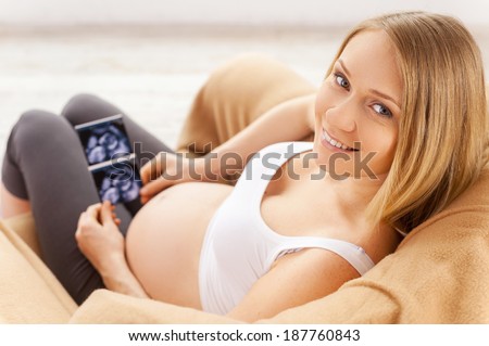 The first photo of my baby. Top view of happy pregnant woman sitting on the chair and holding x-ray image of her baby