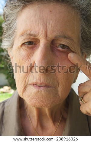 An old woman between 70 and 80 years old is asking to have a look what has entered her eye