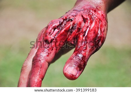 Fake wound on the hands for learning in simulation training for treatment,  Dress the wound, wound makeup special effect, selective focus, abstract blur background, shallow depth of field