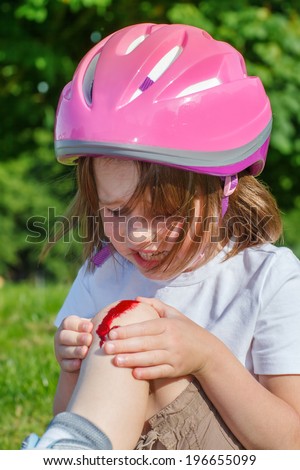 Kid looking at the bleeding knee