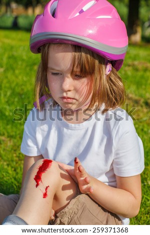 Portrait of an unhappy girl in protective helmet with her knee bleeding