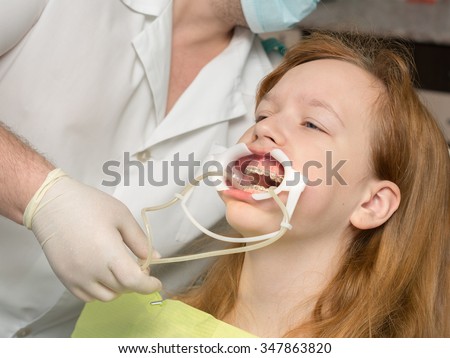 girl in the dentist\'s chair with braces