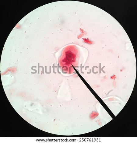 Living healthy cells (mitosis) - original micro-photo of tissue under a microscope