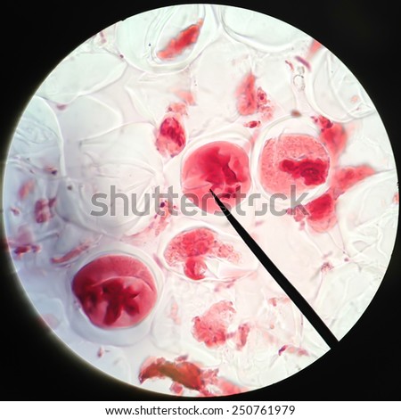 Living healthy cells (mitosis) - original micro-photo of tissue under a microscope