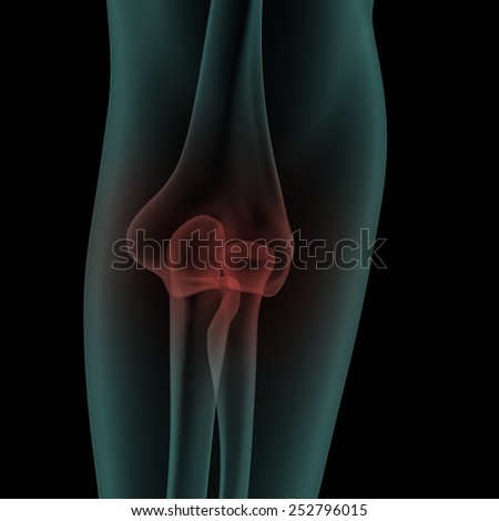 front x-ray scan view of human painful elbow