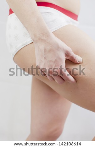 young woman holding her skin for cellulite check