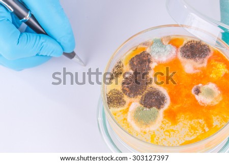 The scientist research. Penicillium fungi on agar plate in laboratory