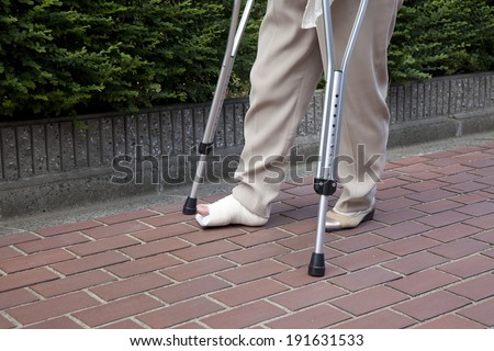 An image of Broken foot