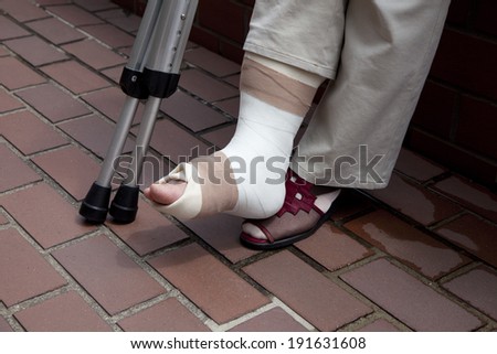 An image of Broken foot