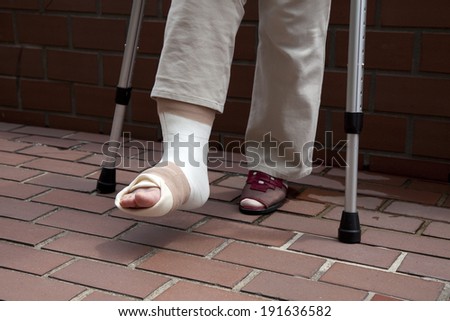 Broken foot