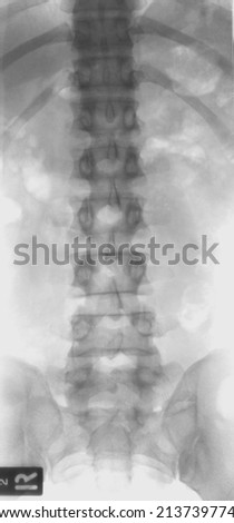 X-ray picture of backbone, through light, studio