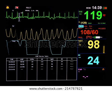 EKG monitor in ICU unit show The waves of blood pressure, blood oxygen saturation, ECG,heart rate