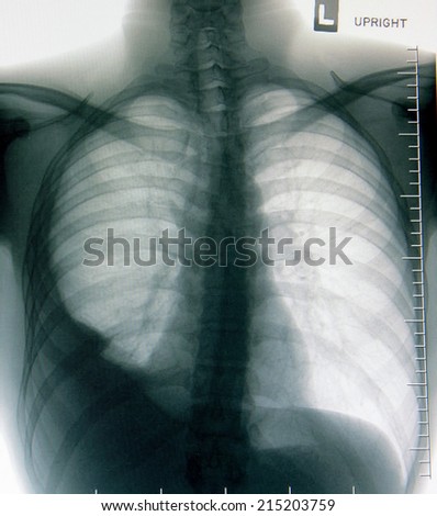 X ray image of a human body on the computer monitor
