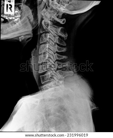 detail of neck x-ray image