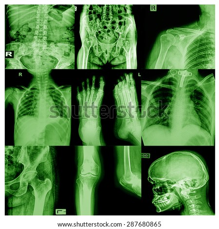 Collection x-ray multiple disease
