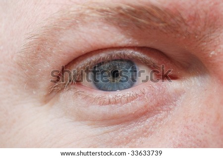man\'s blue eye  with contact lines and wrinkles skin close up.