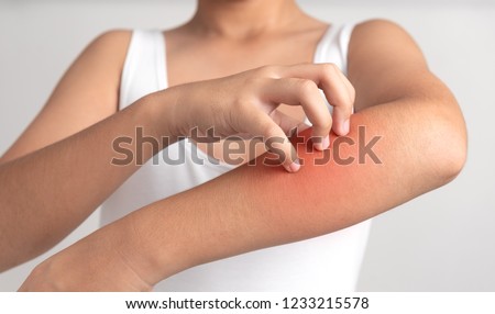 Itching of skin diseases in man using the hand-scratching. Red around the Itching area. The concept with Healthcare And Medicine.