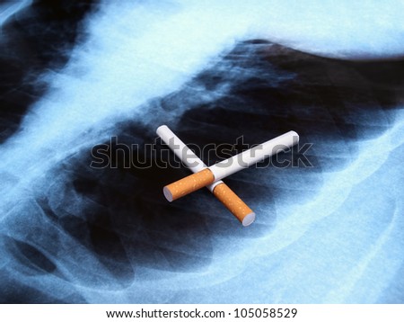 Conceptual image about smoking issues and lung cancer.