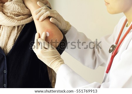 Dermatologist doctor doing treatment, Female patient with allergic rash dermatitis eczema skin, Skin diseases.