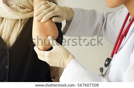 Dermatologist doctor doing treatment, Female patient with allergic rash dermatitis eczema skin, Skin diseases.