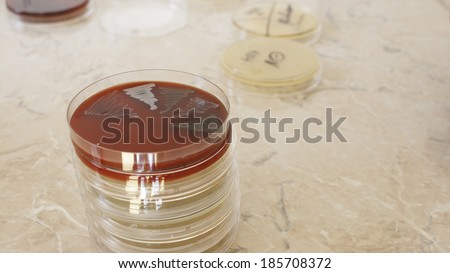Petri dish,  isolated bacteria - columbia blood agar