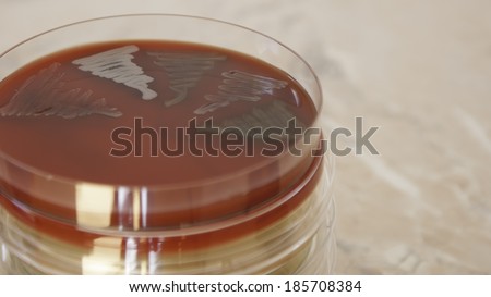 Petri dish,  isolated bacteria - columbia blood agar