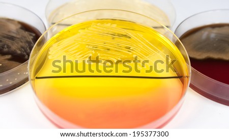 Staphylococcus aureus bacterium on petri dish