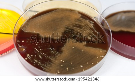 Isolation of throat swab on petri dish