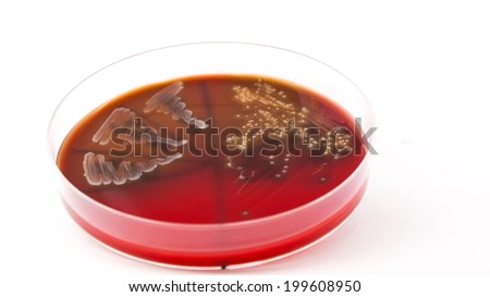 Petri dish with Enterococcus faecalis bacteria