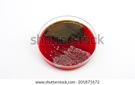 Isolation of throat and nose swab on petri dish