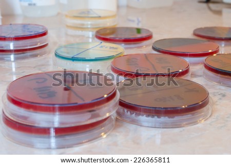 Petri dishes on laboratory table. Laboratory concept