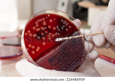 Laboratory doctor holding sterile swab and petri dish with Escherichia Colli. Medical laboratory concept
