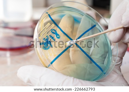 Laboratory doctor hands with sterile gloves holding sterile swab on Cled agar petri dish infected with Escherichia Colli. Medical laboratory concept