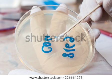 Laboratory doctor hands with sterile gloves holding sterile swab and preparing for an antibiogram on petri dish agar.