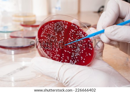 Laboratory doctor hands with sterile gloves holding inoculation loop on blood agar infected with Staphylococcus. Medical laboratory concept