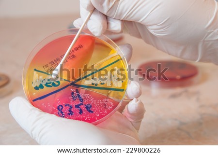 Sterile swab and Staphylococcus aureus bacteria on petri dish. Laboratory doctor holding petri dish. Medical laboratory concept