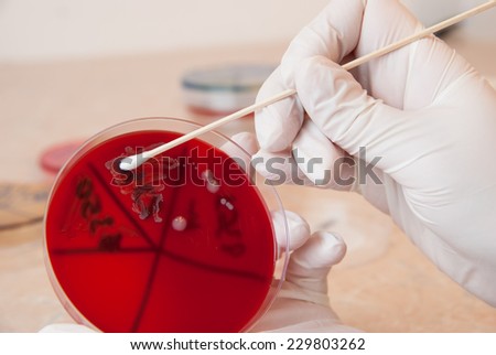 Laboratory doctor retrieving a sample of Enterococcus faecalis bacteria with sterile swab