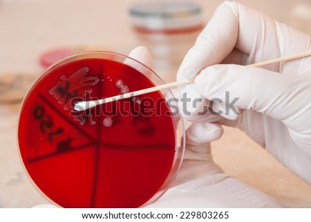 Laboratory doctor retrieving a sample of Enterococcus faecalis bacteria with sterile swab