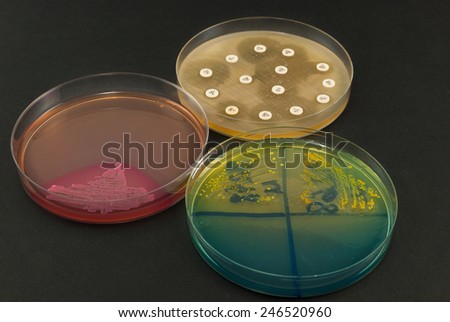 Petri dishes on black background